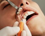A Comprehensive Guide to Achieving Optimal Oral Health: 10 Essential Ways to Care for Your Teeth